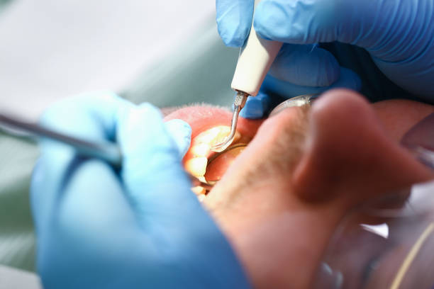 Best Weekend Emergency Dentist in Kulpsville, PA