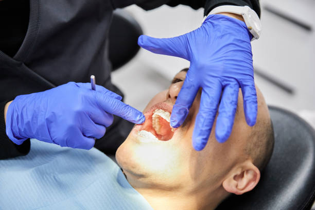 Best Emergency Gum Treatment in Kulpsville, PA