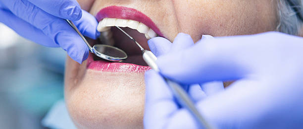 Best Emergency Treatment for Dental Infections or Abscesses in Kulpsville, PA
